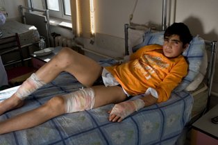 В Карабахе 13-летний подросток подорвался на мине